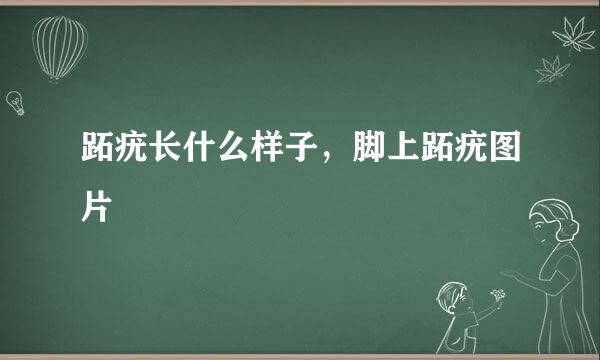 跖疣长什么样子，脚上跖疣图片