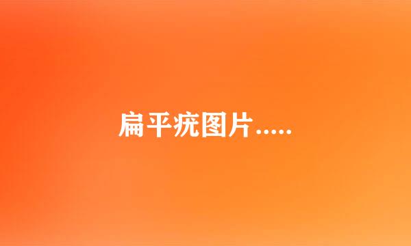 扁平疣图片.....