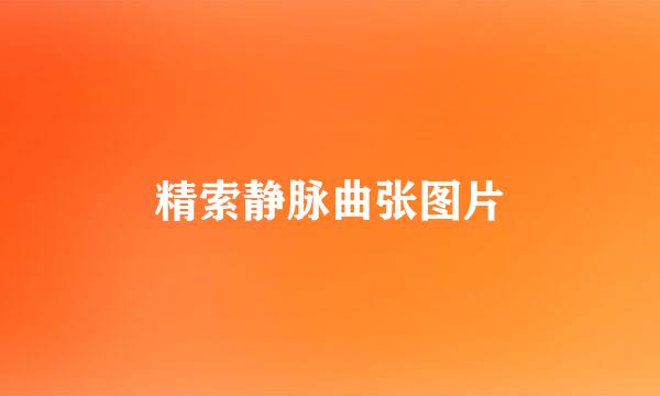 精索静脉曲张图片