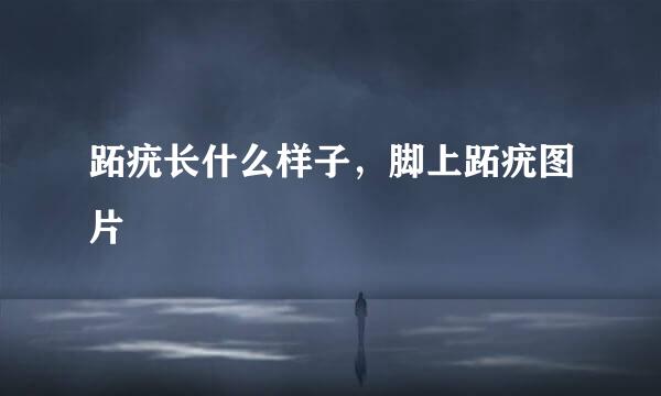 跖疣长什么样子，脚上跖疣图片