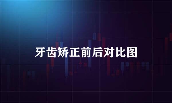 牙齿矫正前后对比图