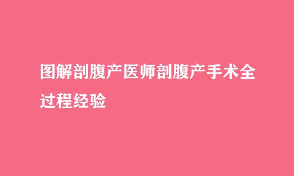 图解剖腹产医师剖腹产手术全过程经验