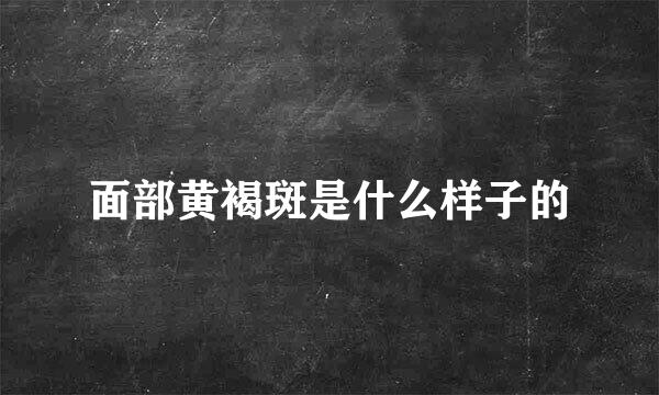 面部黄褐斑是什么样子的