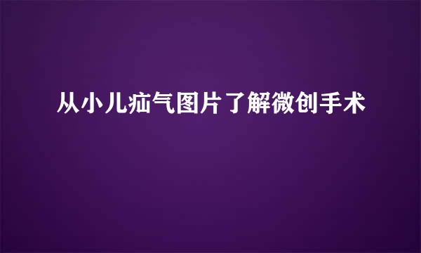 从小儿疝气图片了解微创手术