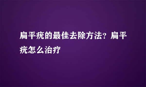 扁平疣的最佳去除方法？扁平疣怎么治疗