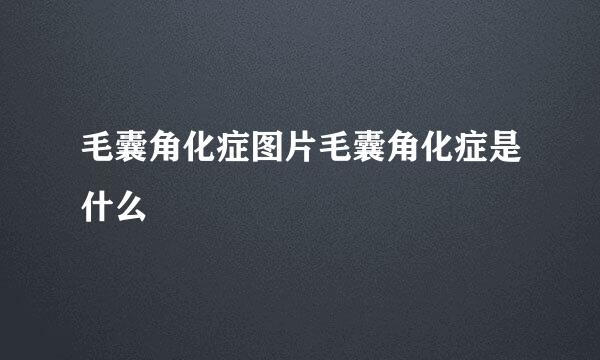 毛囊角化症图片毛囊角化症是什么