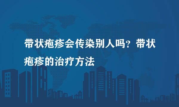 带状疱疹会传染别人吗？带状疱疹的治疗方法