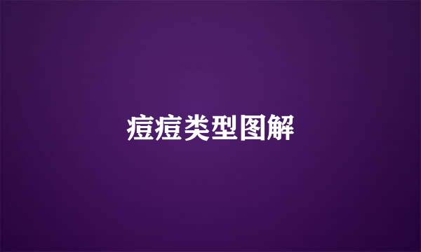 痘痘类型图解