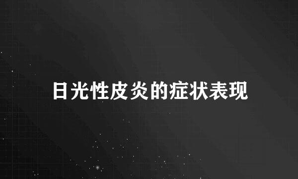 日光性皮炎的症状表现