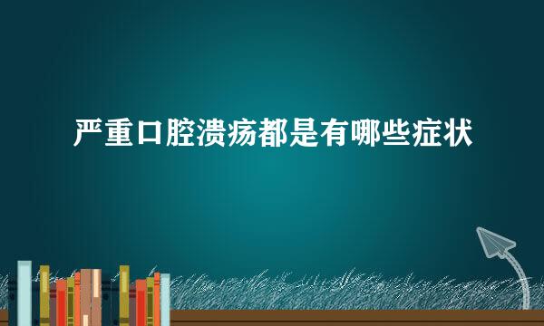 严重口腔溃疡都是有哪些症状