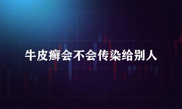 牛皮癣会不会传染给别人