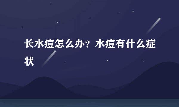 长水痘怎么办？水痘有什么症状