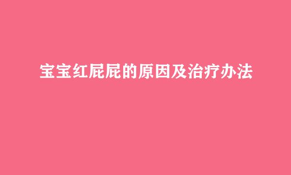 宝宝红屁屁的原因及治疗办法