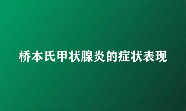 桥本氏甲状腺炎的症状表现