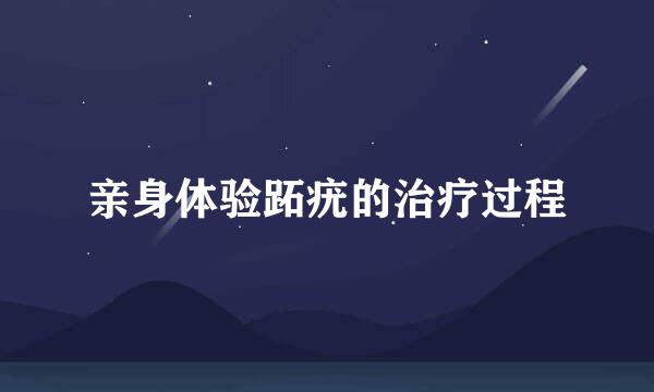 亲身体验跖疣的治疗过程