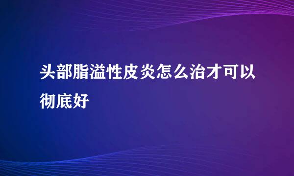 头部脂溢性皮炎怎么治才可以彻底好