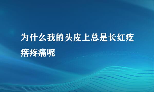 为什么我的头皮上总是长红疙瘩疼痛呢