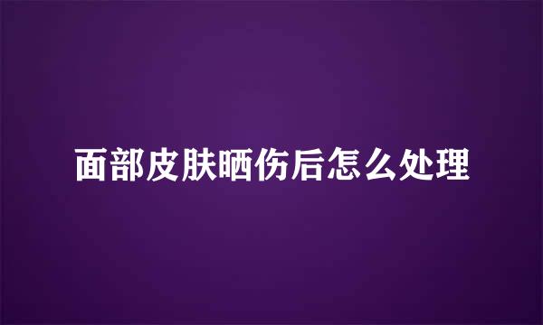面部皮肤晒伤后怎么处理