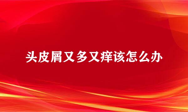 头皮屑又多又痒该怎么办