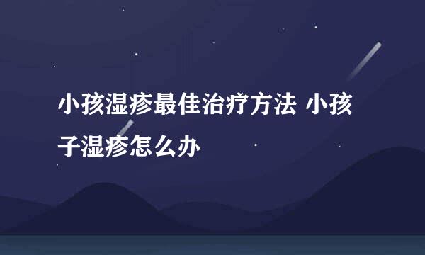 小孩湿疹最佳治疗方法 小孩子湿疹怎么办