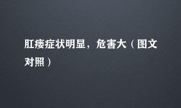 肛瘘症状明显，危害大（图文对照）
