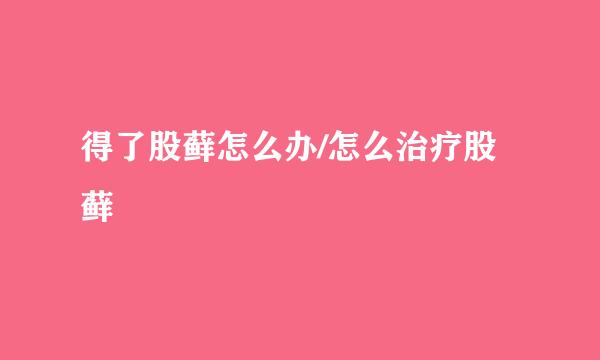 得了股藓怎么办/怎么治疗股藓