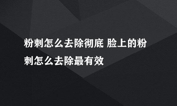 粉刺怎么去除彻底 脸上的粉刺怎么去除最有效