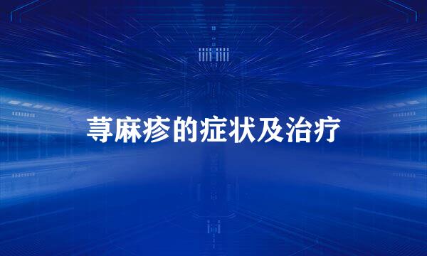 荨麻疹的症状及治疗