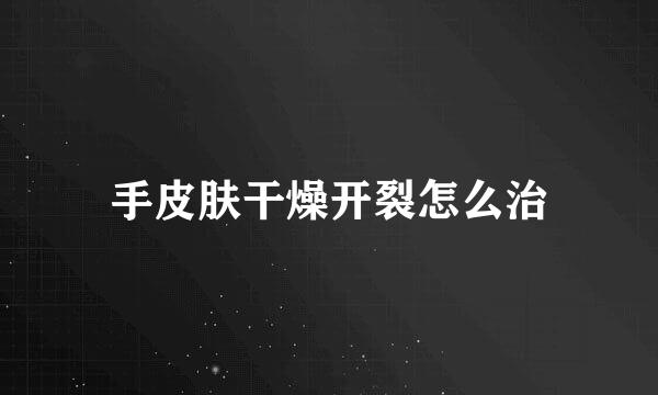 手皮肤干燥开裂怎么治
