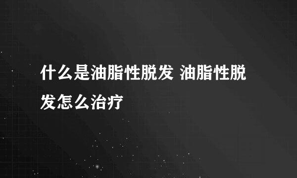 什么是油脂性脱发 油脂性脱发怎么治疗