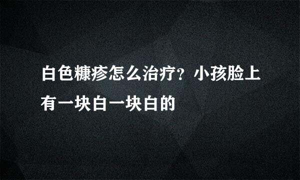 白色糠疹怎么治疗?小孩脸上有一块白一块白的