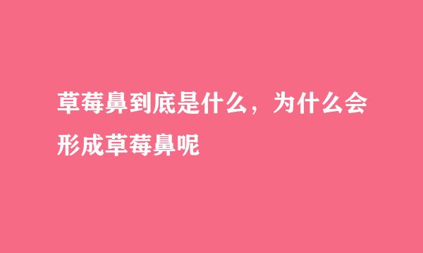 草莓鼻到底是什么，为什么会形成草莓鼻呢