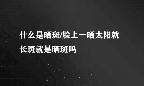 什么是晒斑/脸上一晒太阳就长斑就是晒斑吗