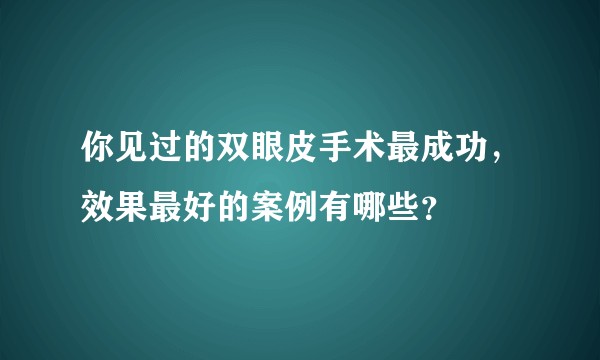 你见过的双眼皮手术最成功，效果最好的案例有哪些？
